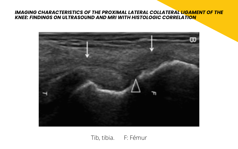 4. Tempo Formacion Ecografia Ligamento colateral lateral.png